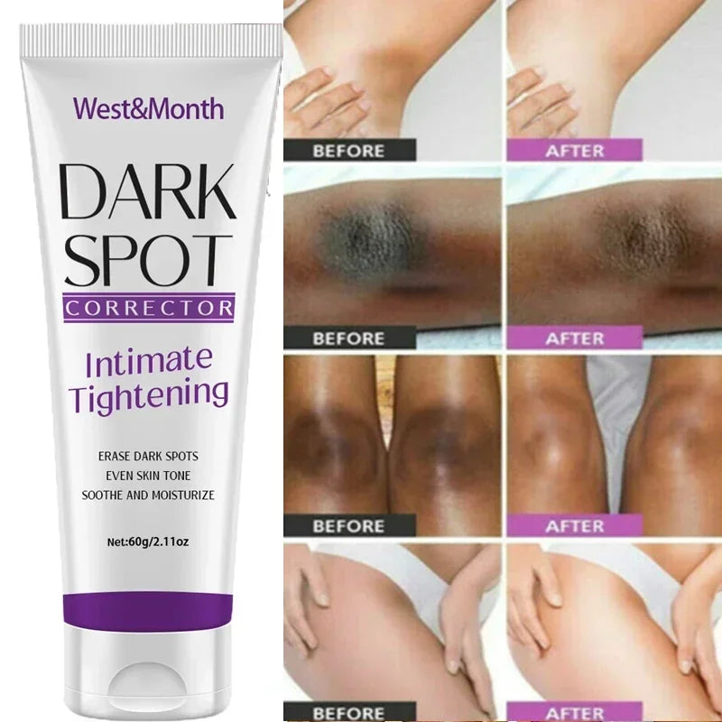 Nicotinamide Brightening Cream For Dark Skin